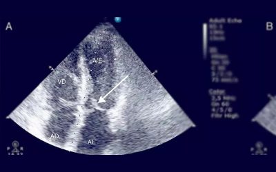 eco-cardiograma